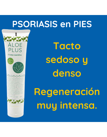 Psoriasis palmo plantar pies crema nutritiva aloe plus